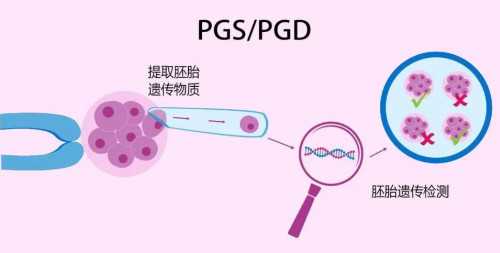试管移植降调打肚子，达菲林的正确操作流程