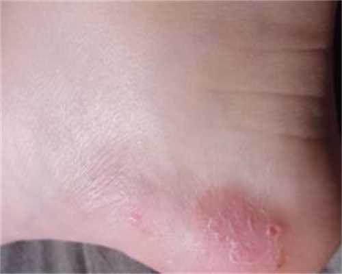 看不孕不育正规医院哪家好南昌