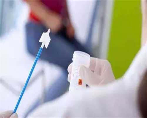 试管代怀套餐-上海甲状腺医院刘金怀医生：亚急性甲状腺炎