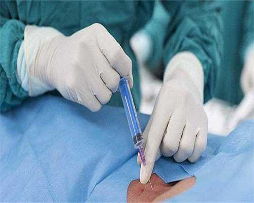 代生产子-超长方案打两针达菲林降调流程是什么