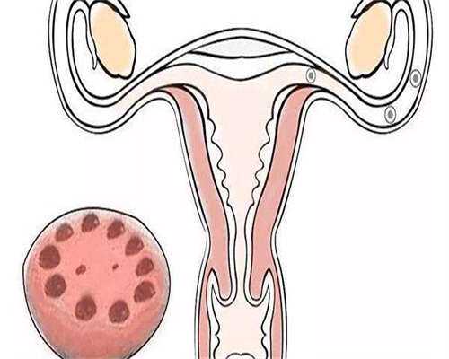 西藏试管婴儿的具体步骤