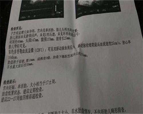 助孕单身女性-「医院导航」第三代试管婴儿就医指南之苏州市立医院