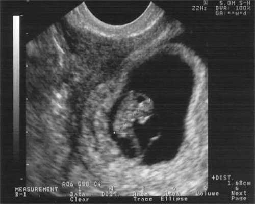 备孕期夫妻做足哪些准备可以减短备孕时间？