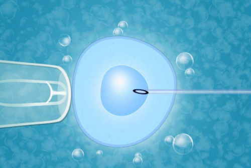 榴莲能否止孕吐？孕吐严重可不可以吃榴莲？