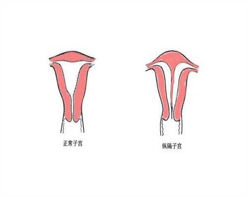 上海看不孕不育正规哪家好