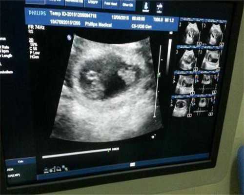 福州三代试管医院哪家好？