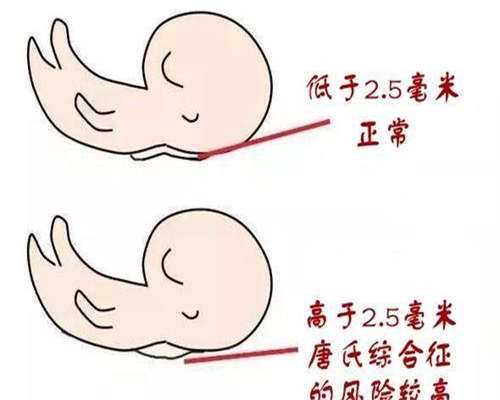 口服黄体酮会有哪些副作用呢？