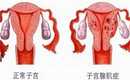 <b>南通妇幼保健院试管婴儿多少钱南通妇幼保健院试管婴儿成功率</b>